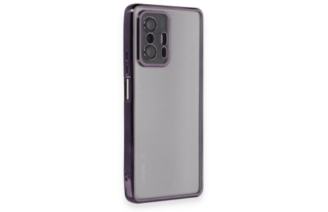 Newface Xiaomi Mi 11T Kılıf Razer Lensli Silikon - Mor