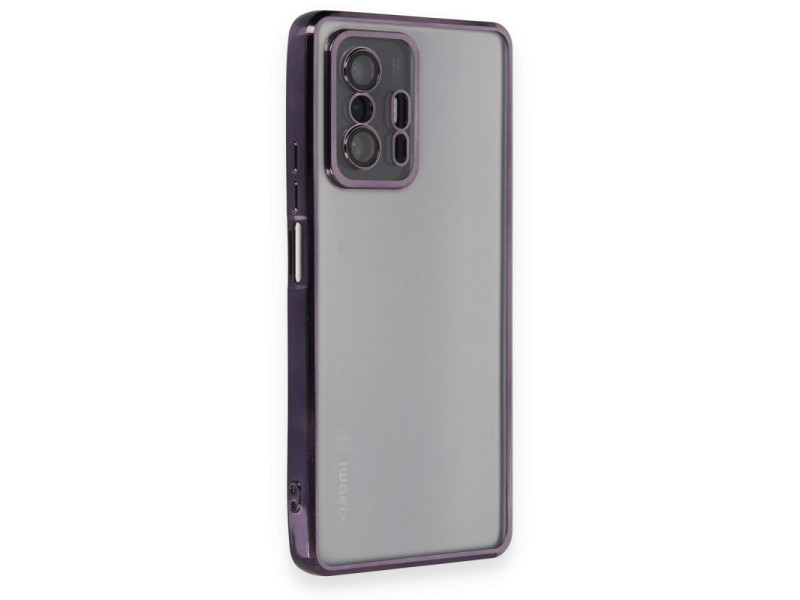 Newface Xiaomi Mi 11T Kılıf Razer Lensli Silikon - Mor