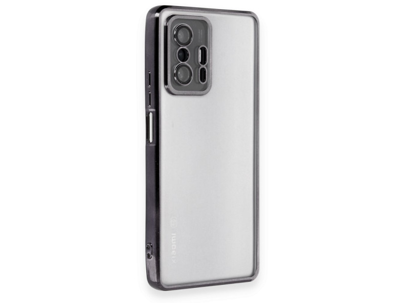 Newface Xiaomi Mi 11T Kılıf Razer Lensli Silikon - Siyah
