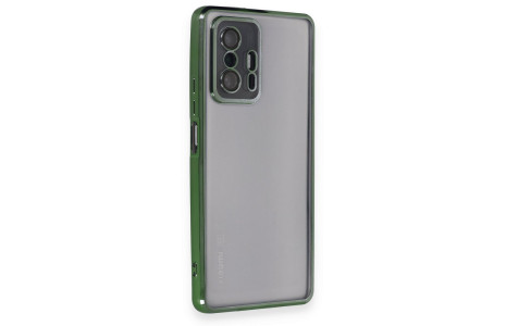 Newface Xiaomi Mi 11T Kılıf Razer Lensli Silikon - Yeşil