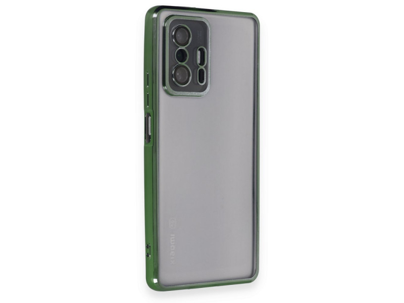 Newface Xiaomi Mi 11T Kılıf Razer Lensli Silikon - Yeşil
