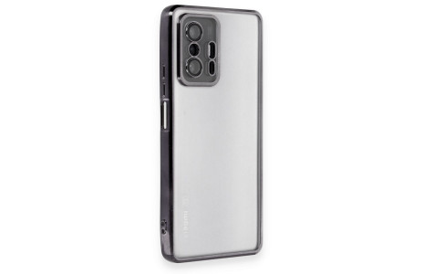 Newface Xiaomi Mi 11T Pro Kılıf Razer Lensli Silikon - Siyah