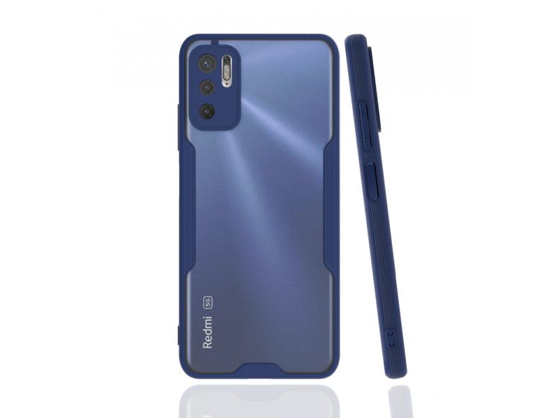 Newface Xiaomi Redmi Note 11 SE Kılıf Platin Silikon - Lacivert
