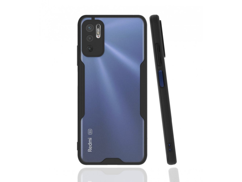 Newface Xiaomi Redmi Note 11 SE Kılıf Platin Silikon - Siyah