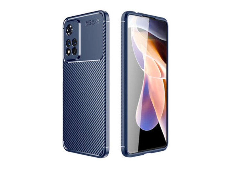 Newface Xiaomi Redmi Note 11 Pro Plus 5G Kılıf Focus Karbon Silikon - Lacivert