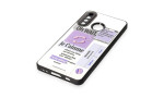 Newface Huawei P30 Lite Kılıf Mirror Desenli Kapak - Mirror - 4