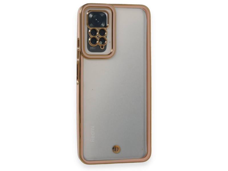 Newface Xiaomi Redmi Note 11S Kılıf Liva Lens Silikon - Pudra