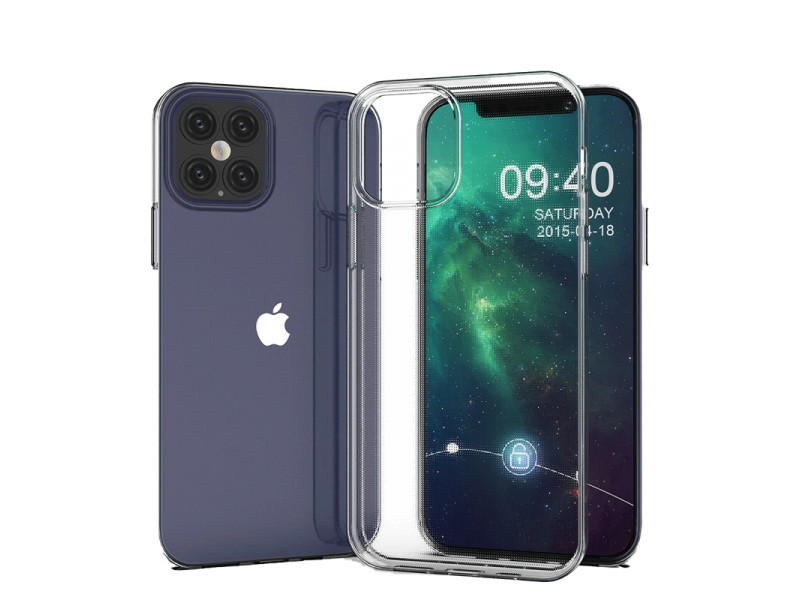 Newface iPhone 12 Pro Kılıf Lüx Şeffaf Silikon