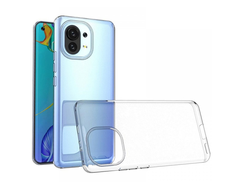 Newface Xiaomi Mi 11 Kılıf Lüx Şeffaf Silikon
