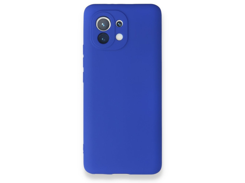 Newface Xiaomi Mi 11 Kılıf First Silikon - Lacivert