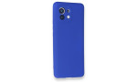 Newface Xiaomi Mi 11 Kılıf First Silikon - Lacivert