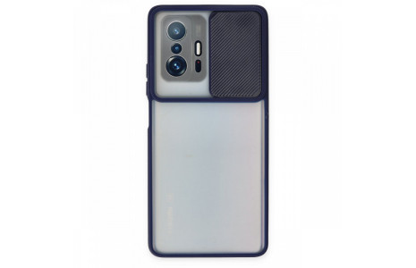 Newface Xiaomi Mi 11T Kılıf Palm Buzlu Kamera Sürgülü Silikon - Lacivert