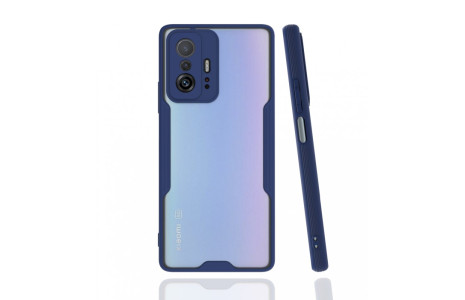 Newface Xiaomi Mi 11T Kılıf Platin Silikon - Lacivert