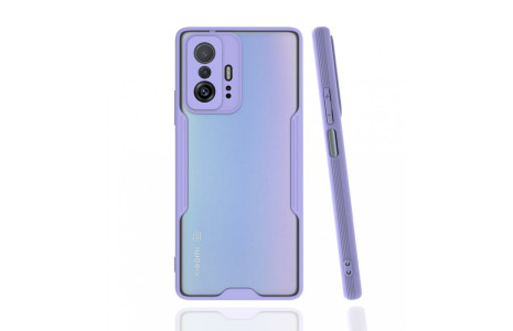 Newface Xiaomi Mi 11T Kılıf Platin Silikon - Lila