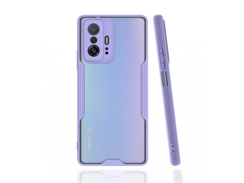 Newface Xiaomi Mi 11T Kılıf Platin Silikon - Lila