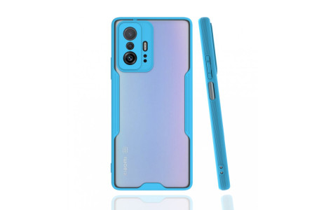 Newface Xiaomi Mi 11T Kılıf Platin Silikon - Mavi