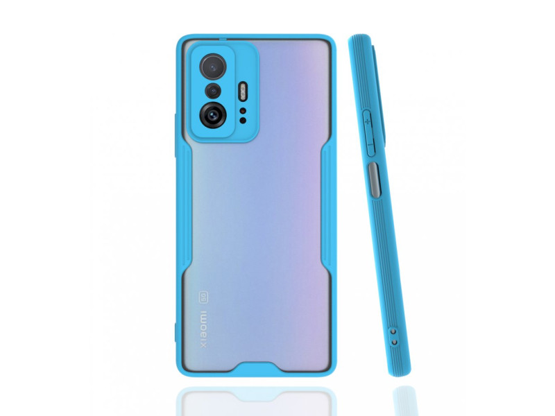 Newface Xiaomi Mi 11T Kılıf Platin Silikon - Mavi