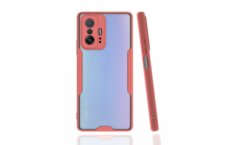 Newface Xiaomi Mi 11T Kılıf Platin Silikon - Pembe