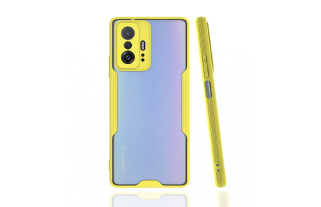 Newface Xiaomi Mi 11T Kılıf Platin Silikon - Sarı