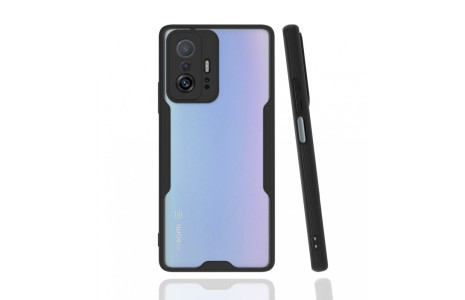 Newface Xiaomi Mi 11T Kılıf Platin Silikon - Siyah