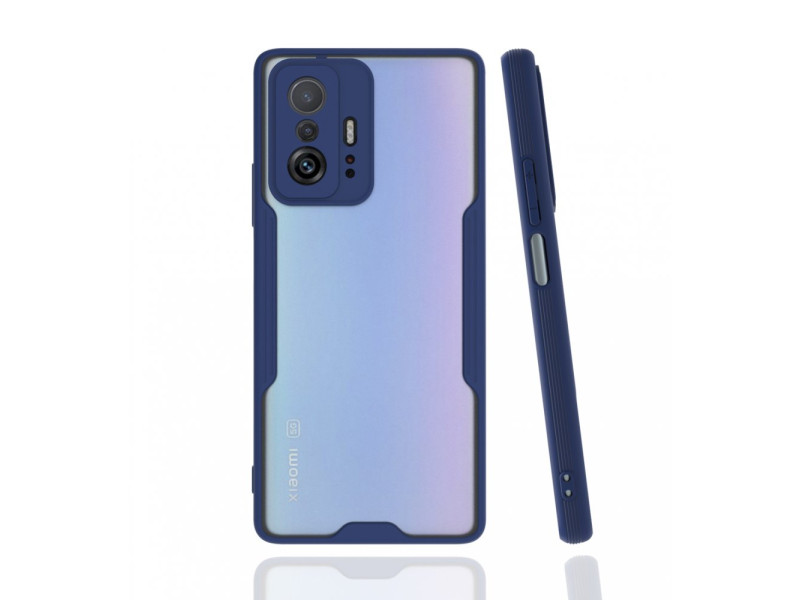 Newface Xiaomi Mi 11T Pro Kılıf Platin Silikon - Lacivert