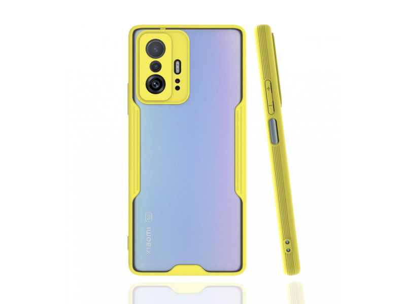 Newface Xiaomi Mi 11T Pro Kılıf Platin Silikon - Sarı