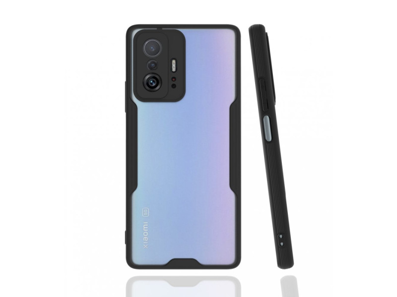 Newface Xiaomi Mi 11T Pro Kılıf Platin Silikon - Siyah