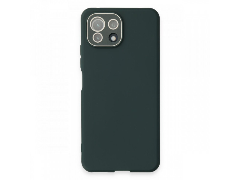 Newface Xiaomi Mİ 11 Lite Kılıf Lansman Glass Kapak - Koyu Yeşil