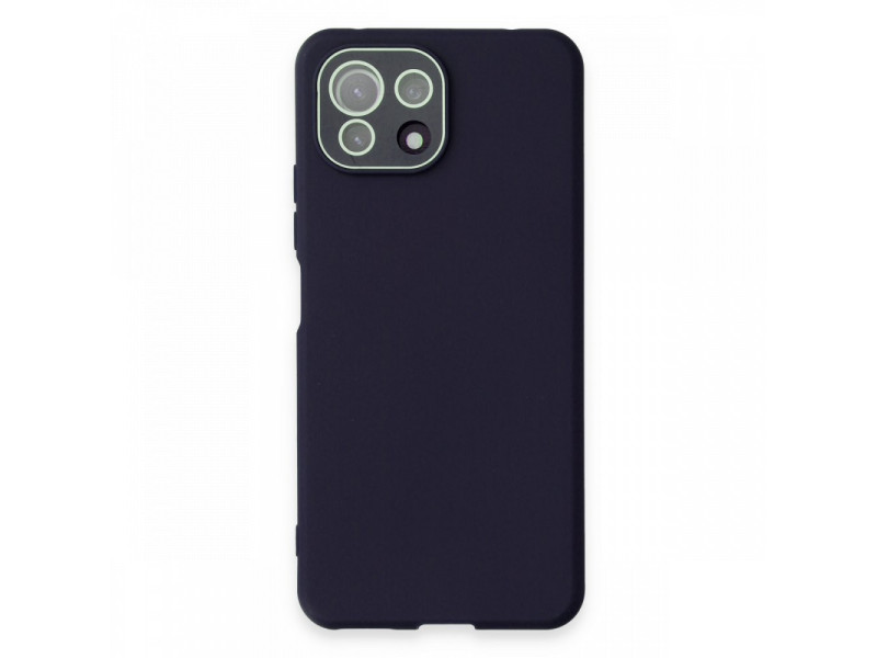 Newface Xiaomi Mİ 11 Lite Kılıf Lansman Glass Kapak - Lacivert