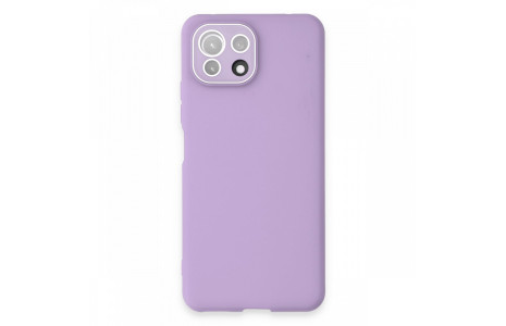 Newface Xiaomi Mİ 11 Lite Kılıf Lansman Glass Kapak - Lila