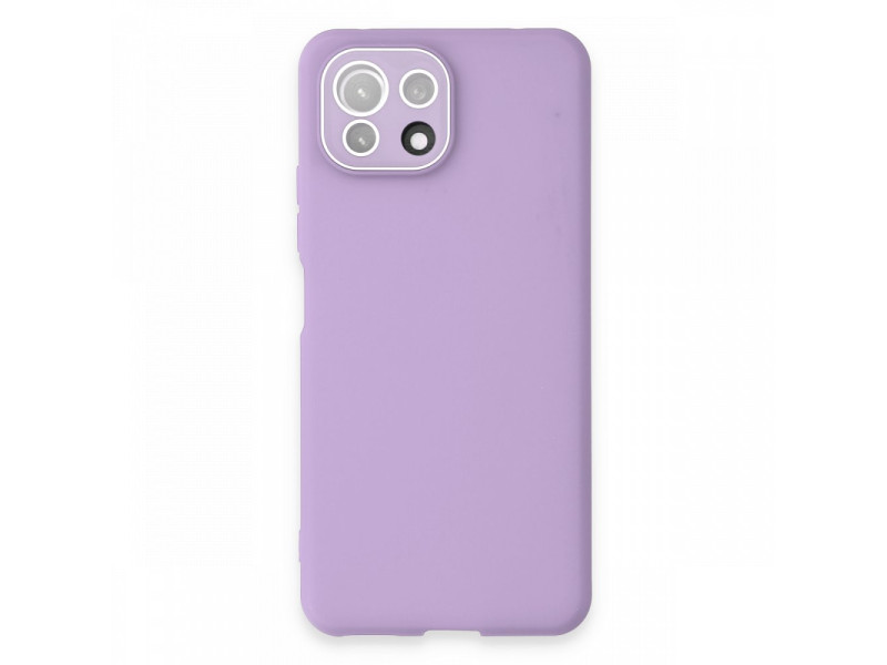 Newface Xiaomi Mİ 11 Lite Kılıf Lansman Glass Kapak - Lila