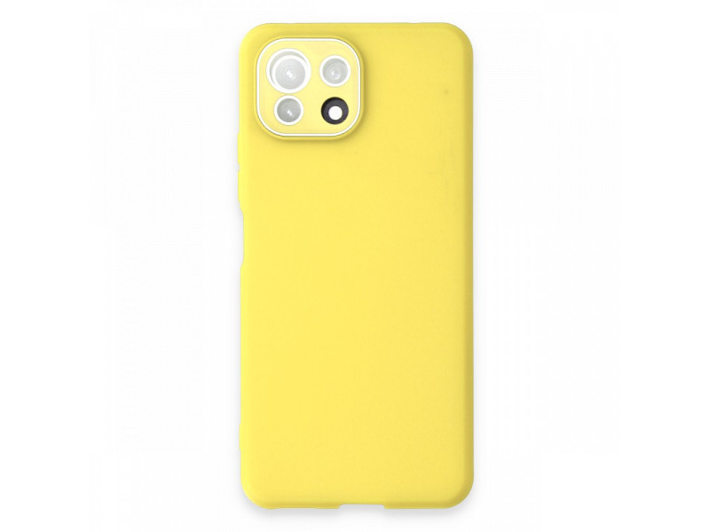 Newface Xiaomi Mİ 11 Lite Kılıf Lansman Glass Kapak - Sarı