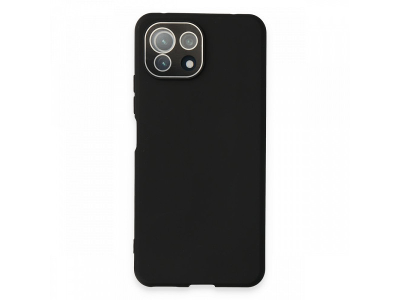 Newface Xiaomi Mİ 11 Lite Kılıf Lansman Glass Kapak - Siyah