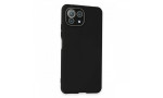 Newface Xiaomi Mİ 11 Lite Kılıf Lansman Glass Kapak - Siyah