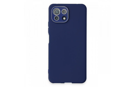 Newface Xiaomi Mİ 11 Lite Kılıf Lansman Glass Kapak - Sky Blue
