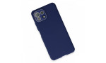 Newface Xiaomi Mİ 11 Lite Kılıf Lansman Glass Kapak - Sky Blue