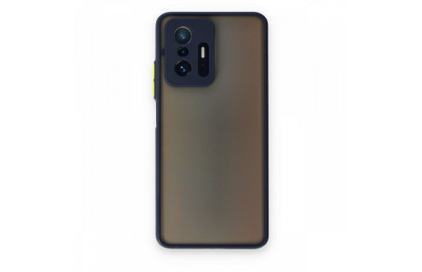 Newface Xiaomi Mi 11T Kılıf Montreal Silikon Kapak - Lacivert