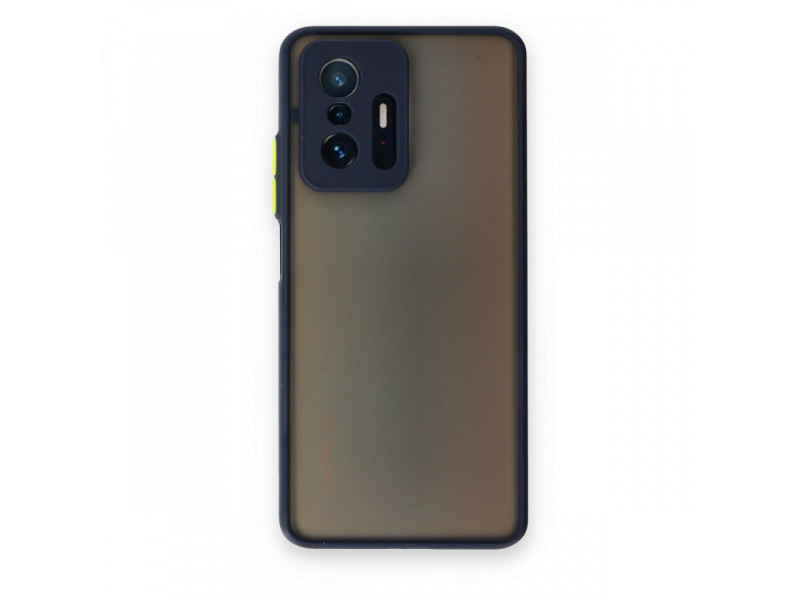 Newface Xiaomi Mi 11T Pro Kılıf Montreal Silikon Kapak - Lacivert