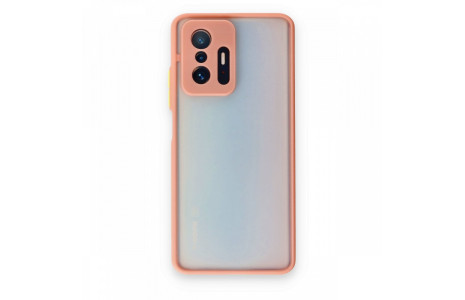 Newface Xiaomi Mi 11T Pro Kılıf Montreal Silikon Kapak - Pembe