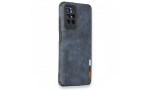 Newface Xiaomi Redmi 10 2022 Kılıf Loop Deri Silikon - Lacivert