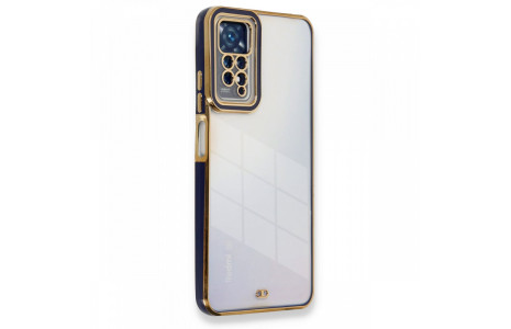 Newface Xiaomi Redmi Note 11 Pro Kılıf Liva Lens Silikon - Mavi