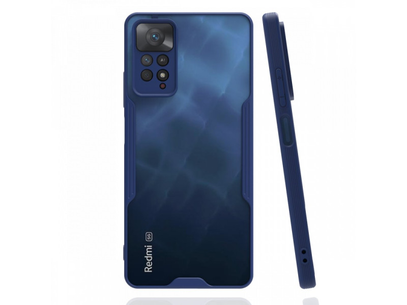 Newface Xiaomi Redmi Note 11 Pro Kılıf Platin Silikon - Lacivert