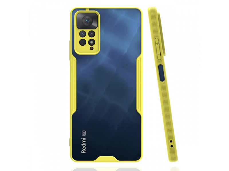 Newface Xiaomi Redmi Note 11 Pro Kılıf Platin Silikon - Sarı