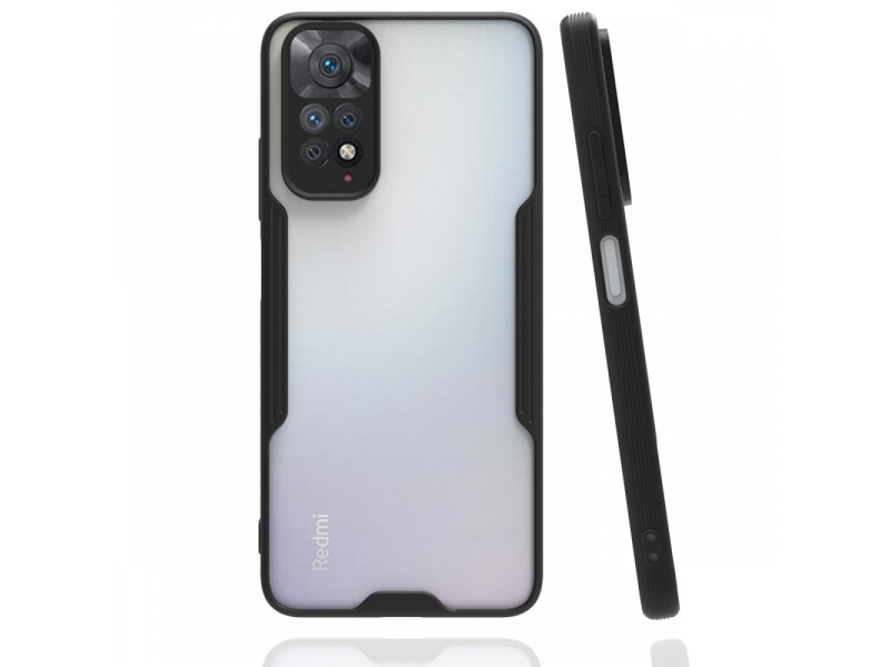 Newface Xiaomi Redmi Note 11S Kılıf Platin Silikon - Siyah