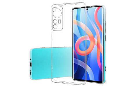 Newface Xiaomi Mi 12X Kılıf Lüx Şeffaf Silikon