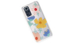 Newface Xiaomi Redmi Note 11 Kılıf Lucky Silikon - Lucky 7