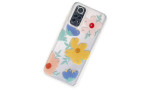 Newface Xiaomi Redmi Note 11 Kılıf Lucky Silikon - Lucky 7