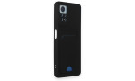 Newface Xiaomi Redmi Note 11 Pro Kılıf Kelvin Kartvizitli Silikon - Siyah