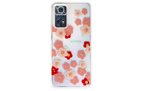 Newface Xiaomi Redmi Note 11 Pro Kılıf Lucky Silikon - Lucky 3
