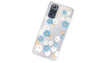 Newface Xiaomi Redmi Note 11S Kılıf Lucky Silikon - Lucky 2
